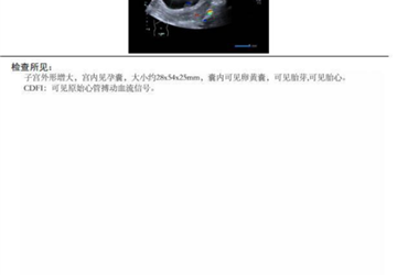 突破！蚌埠市中心医院首例夫精人工授精助孕成功